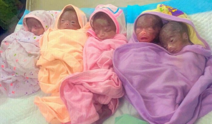 Sextuplets die in Karachi within a week