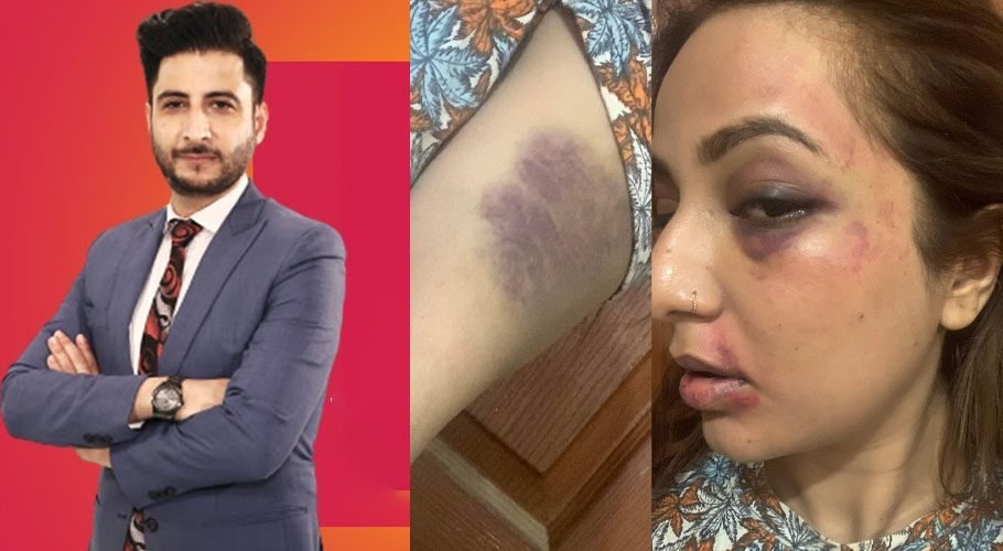 Domestic Violence Scandal: Anchorperson Ashfaq Ishaq Satti Booked Over Allegations by Wife