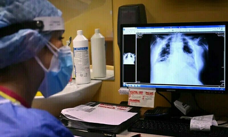 Pneumonia Tightens Its Grip in Punjab and KP, Takes 14 More Lives