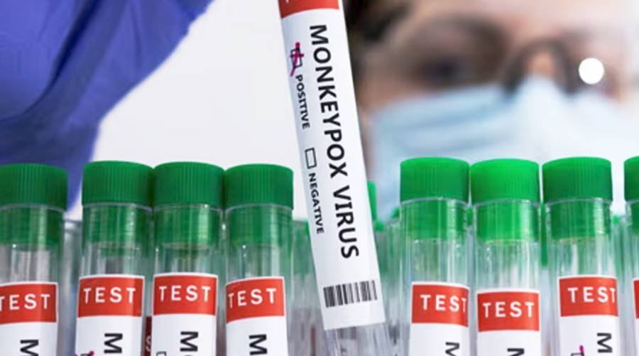 Health Ministry Reports Pakistan’s Second Mpox Case Detected in Peshawar