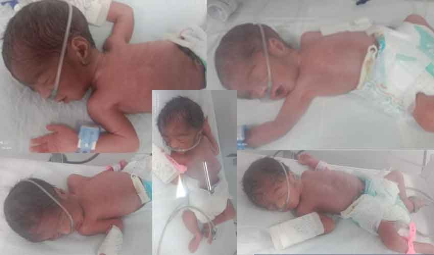 Karachi Couple Welcomes Quintuplets Amid Health Complications The children are underweight and are being treated in the hospital