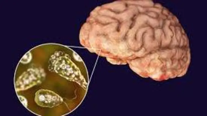 India Issues Health Alert as Fatal ‘Brain-Eating’ Amoeba Cases Surge in Kerala