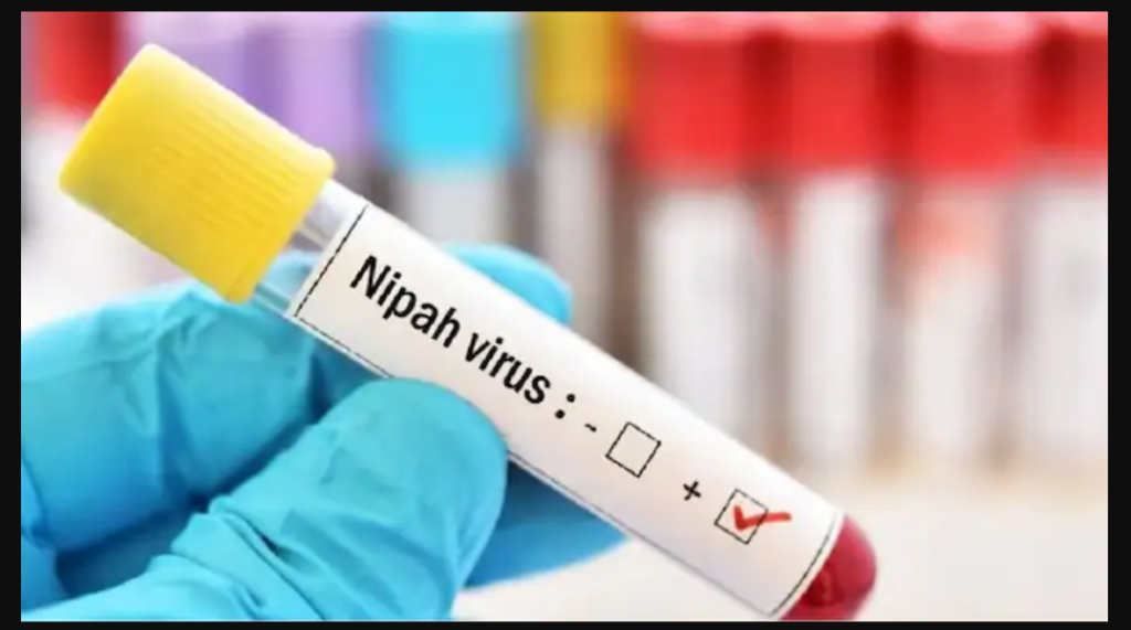 Pakistan Raises Alarm Over Nipah Virus Spread in India Ahead of T20 World Cup Nipah virus